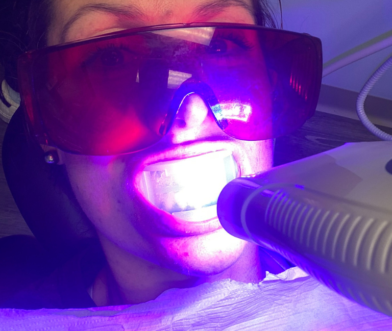 Teeth Whitening Myths You Need to Stop Believing (Right Now!)